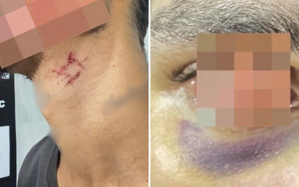 Jovem é resgatado após mais de 1 ano em cárcere sendo explorado sexualmente por traficante, diz polícia